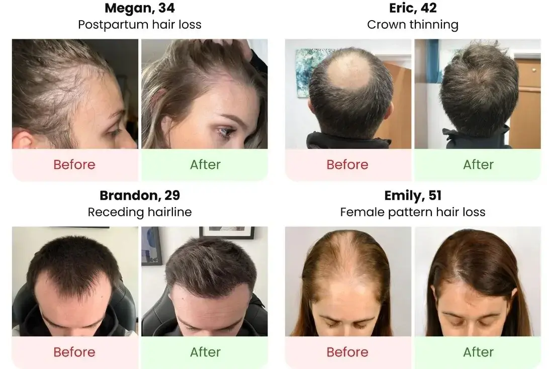 Before and after results from real Scalpistry users